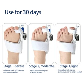 ZAWELIYO Corrector de juanetes dolorless ajustable con almohadilla de gel suave para alivio de buniones corrector ortopédico de dedos separador de dedos 3D knob diseño ajustable sin