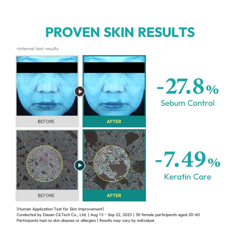 Exome Exorra 4X Active Gel AHA BHA PHA LHA Peeling