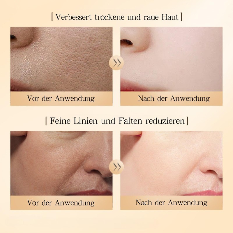 2er-Set Gesichtsserum für Frauen mit Schneckenschleim & Rosenextrakt–60 Kapseln–Anti-Aging Serum