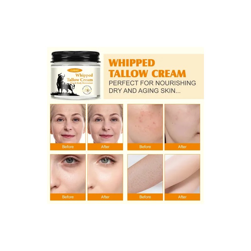 Crema Hidratante Piel Reseca Sebo Res Miel Natural