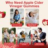 Apple Cider Vinegar Gummies for Daily Wellness, Digestive Support &