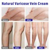 Varicose Veins Treatment for Legs, Varicose Veins Cream Improve Blood