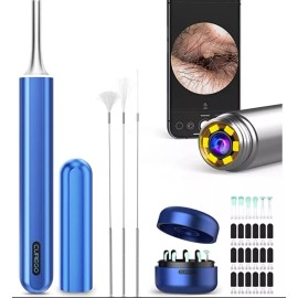 Curego X17 Pro Max Ear Wax Removal Camera Endoscope, All Aluminum Body - Blue