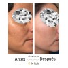 Crema Aclarante, Antiarrugas, Quita Mancha Acido Hialurónico