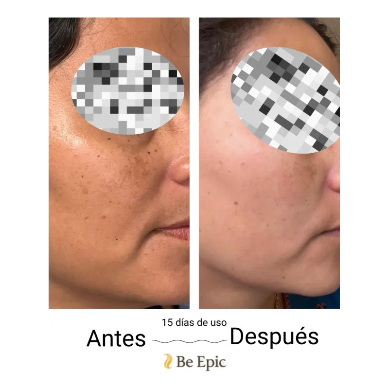 Crema Aclarante, Antiarrugas, Quita Mancha Acido Hialurónico