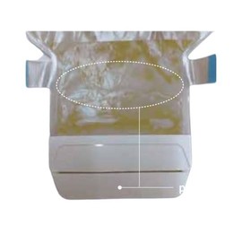 Coroplast 10481 Sensura Mio 1 Single Piece Orthotic for Gastrointestinal Stomers, Transparent 0.4 - 2.2 inches (10 - 55 mm), 1 Box (10 Pieces)