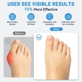 LEOWEER Bunion Pain Sleeve,Breathable Bunion Big Toe Sock with Anti-Slip Heel Grip,Extra Thick Gel Pads & Adjustable Straps for Hallux Valgus Comfort,4 Sizes for Men & Women.