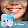 Spa-Dent Whitening Kit – Dental Office Technology – Made in