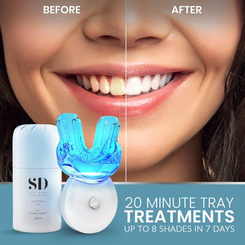 Spa-Dent Whitening Kit – Dental Office Technology – Made in