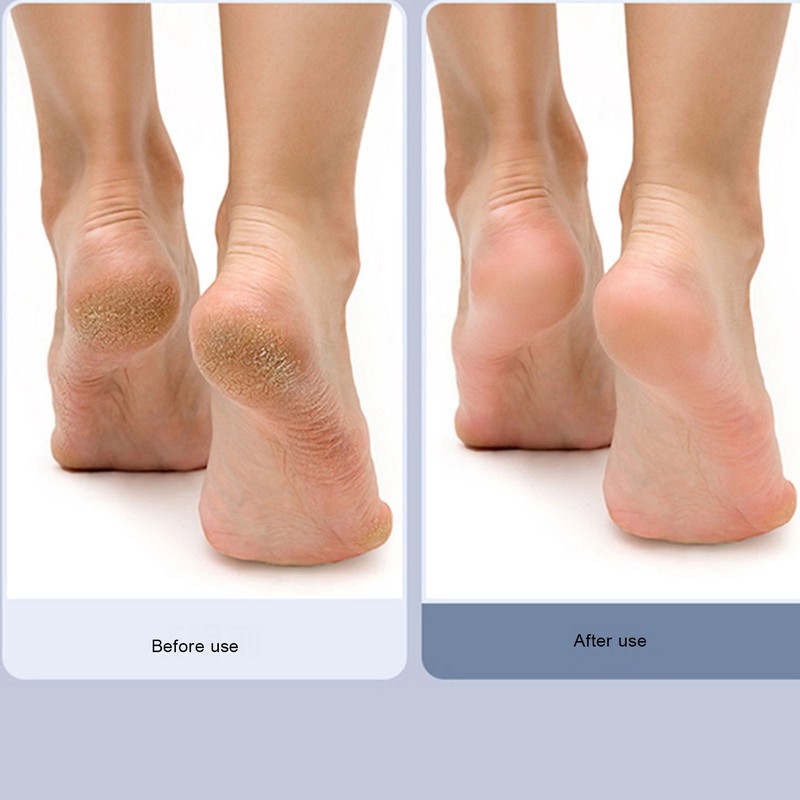Electric Foot Scrubber Adjustable 2 Gears USB Rechargeable Callus Remover