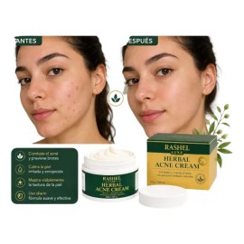 Crema Herbal Tratamiento Acné, Control Grasa, Minimiza Poros