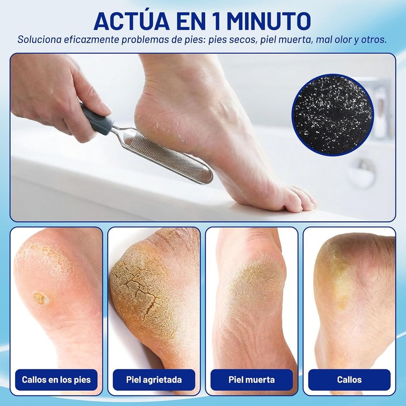 Foot Callus Remover Gel Extra Strength 6 oz – GIVOOBE