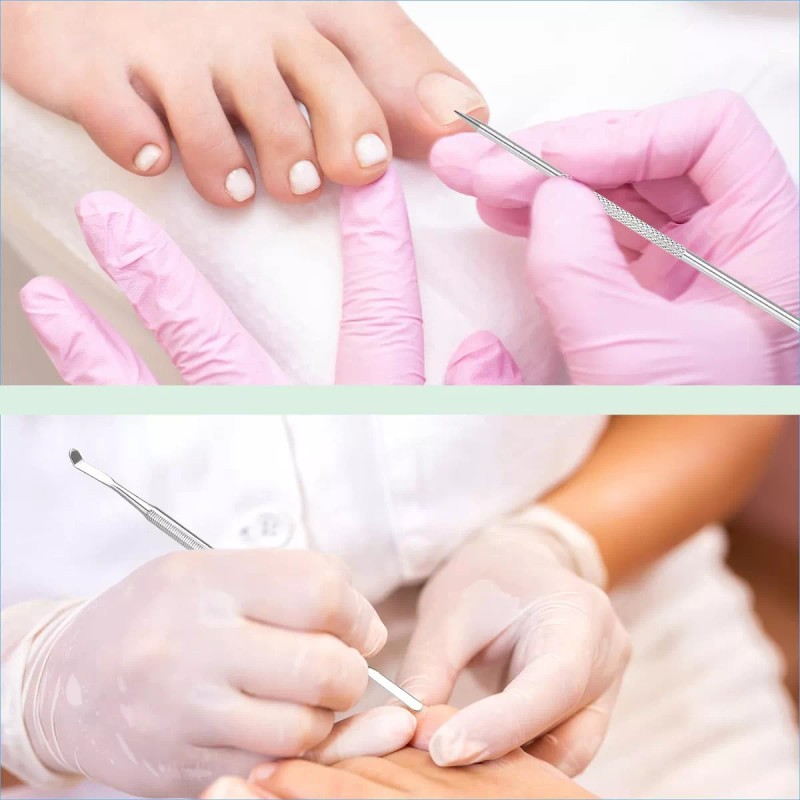 KuanStore Lima Y Levantadores De Uñas Encarnadas, Paquete De 6,