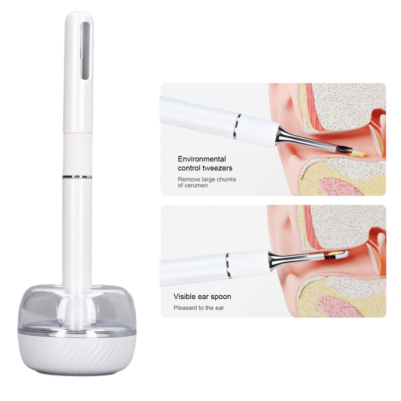 Smart Visible Ear Cleaner 10MP HD 360 Degree Wide Angle