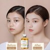 Water Luminous/Wrinkle Free/Salmon/Water-Shine/Functional/Elasticity/Ampoule/Super-Fast/Cell