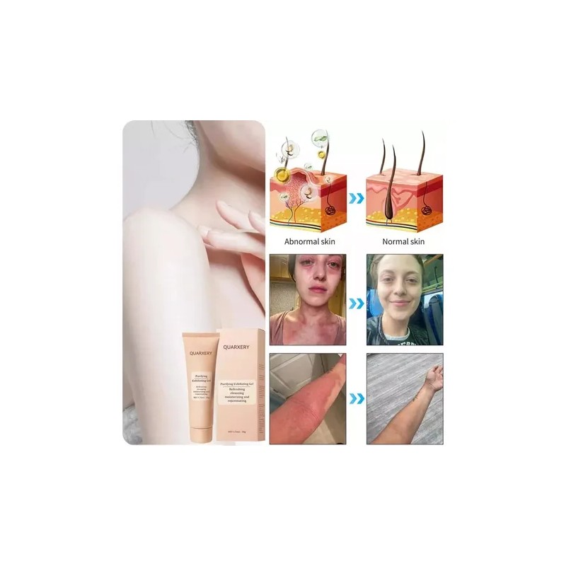 Mr Gel Exfoliante Purificante Quarxery, Gel Exfolianteduy56