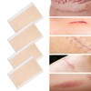 4 Pcs Elaimei Silicone Scar Sheets Stretch Marks Remover Post