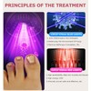 iKeener Nail Lamp &Nailfungus Light Treatment Device For Toenail &