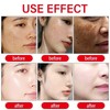 Kojic Acid Whitening Body Lotion 250g Brightening & Moisturizing Formula