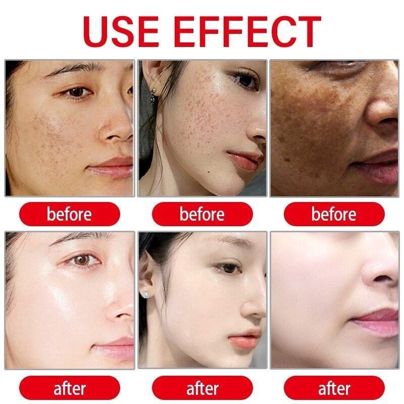 Kojic Acid Whitening Body Lotion 250g Brightening & Moisturizing Formula