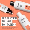 Nioxin Scalp + Hair System 4 Conditioner for Damaged, Visibly