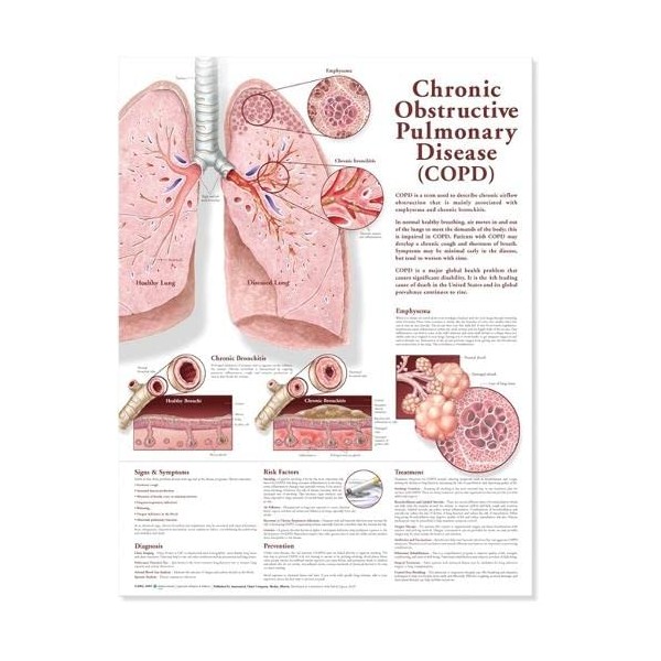 Chronic Obstructive Pulmonary Disease Anatomical Chart