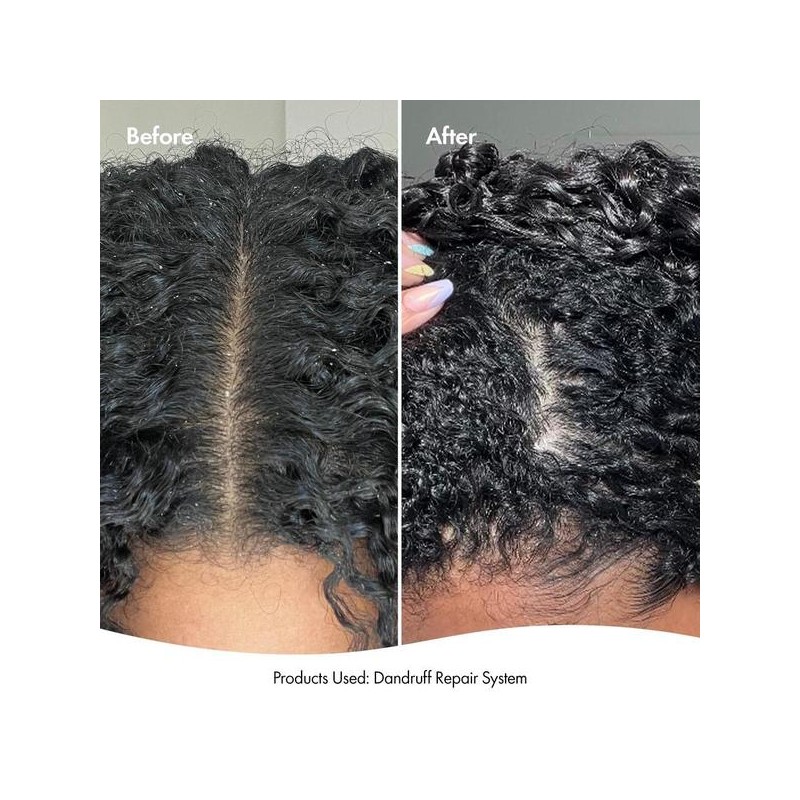 Bondi Boost Dandruff Repair Leave In Scalp Serum 125ml