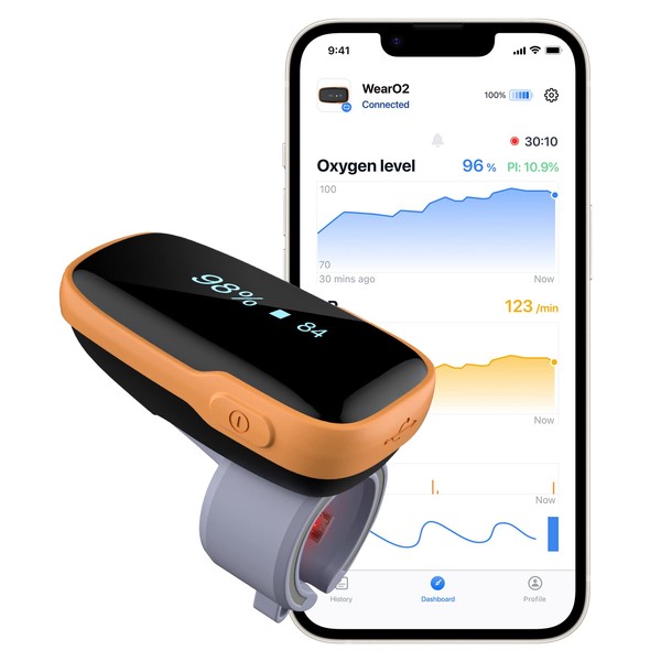 Wellue Bluetooth Pulse Oximeter, Oxygen Saturation Meter Finger, Pulse Oximeter Finger Oximeter with Vibration Alarm and Free App, Rechargeable