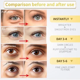Under Eye Patches - 30 Pairs - 24K Gold Eye Mask- Puffy Eyes & Dark Circles Treatments,Reduce Under Eye Bags and Smooth Wrinkles,Eye Skin Care Pads With Collagen