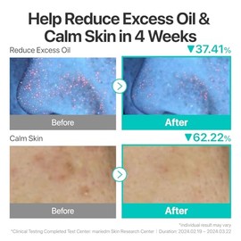 numbuzin Suero No.1 | Suero Calmante Activo Pantoténico B5 | Calmante, Hidratante | Ácido Pantoténico, Niacinamida | Control Del Exceso De Aceite, Reduce Los Brotes, Acné | Piel Grasa, Propensa Al Acn
