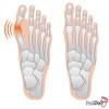 Bunion Corrector and Bunion Relief Sleeves Kit - Hallux Valgus
