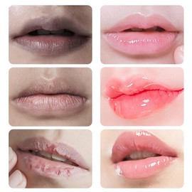 Fast Lightening Pink Mouth Lips Serum Bleaching Permanent Pinkish Moisturizing Lighten Dark Lip Balm Gloss Lipstick Lip Mask13ML - Color: Buy3get2free