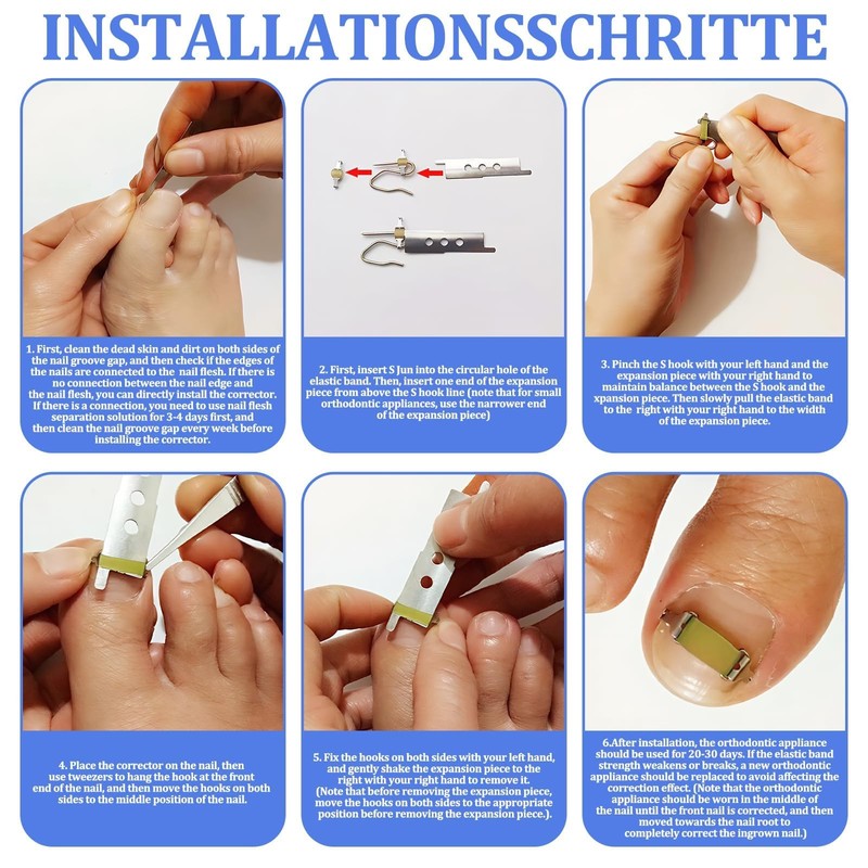 Pack of 25 Nail Clips, Toenails, Easy to Use for
