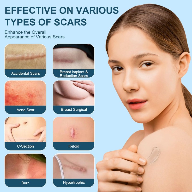 Mitgary Advanced Scar Gel, Silicone Scar Gel, Treats Old and