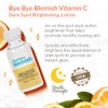 Bye Bye Blemish Dark Spot Lotion Vitamin C | Assists