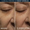Roc Retinol Correxion Crema De Noche Antienvejecimiento Anti