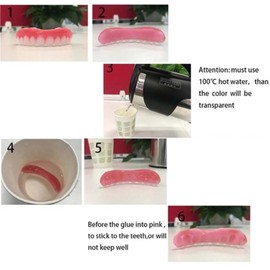Dentures, temporary repair denture paste surface, make your own temporary denture paste surface, simple top and bottom denture glue, male and female paste surface for men and women can paste dentures