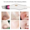 Facial Pore Sucker 3 Modes Adjustment ABS Housing Deep Cleaning