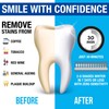 Pro Intellident Teeth Whitening Strips | Home Teeth Whitening Strips