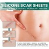 2 cajas Parche de silicona para cicatrices, adecuado para cicatrices