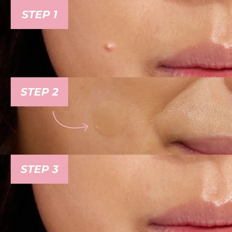 MCoBeauty Clear Miracle Xtreme Day & Night Pimple Patches