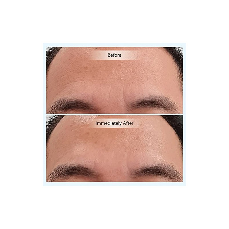 Relleno instantáneo activador juvenil