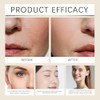 Strawberry Skin Treatment Cream, 118g Exfoliating Moisturizing Lotion for Bumpy
