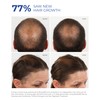 BosleyMD BosRevive KIT for Visible Hair Thinning (Color Safe), Starter