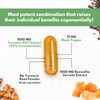 Turmeric Boswellia Extract Supplement 2000 mg – Extra Strength Boswellia