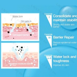 Cerave Facial Cleanser (Foaming | Hydrating | Salicylic Acid SA Smoothing | Moistursing Lotion | Moisturizing cream 340g）