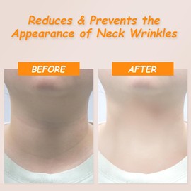 LIUZONGIN 2 Pack Neck Wrinkle Patches Preventing Neck Wrinkles Neck Care Reusable Silicone Neck Patch Make Skin Firmer Neck Anti-aging Neck Skin Hydration and Moisturizing