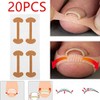 Tiras Correctoras de Uñas Encarnadas, Transpirables, Seguras, Eficaces, Tratamiento de