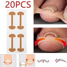 Tiras Correctoras de Uñas Encarnadas, Transpirables, Seguras, Eficaces, Tratamiento de Paroniquia, Pegatinas Correctoras de Uñas de Algodón para el Ho