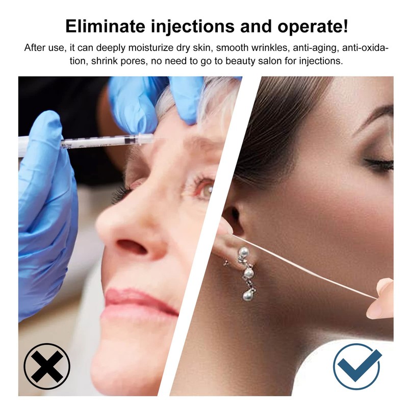 Face Lifting, Collagen Silk Threads, Collagen Silk Threads for Lifting,